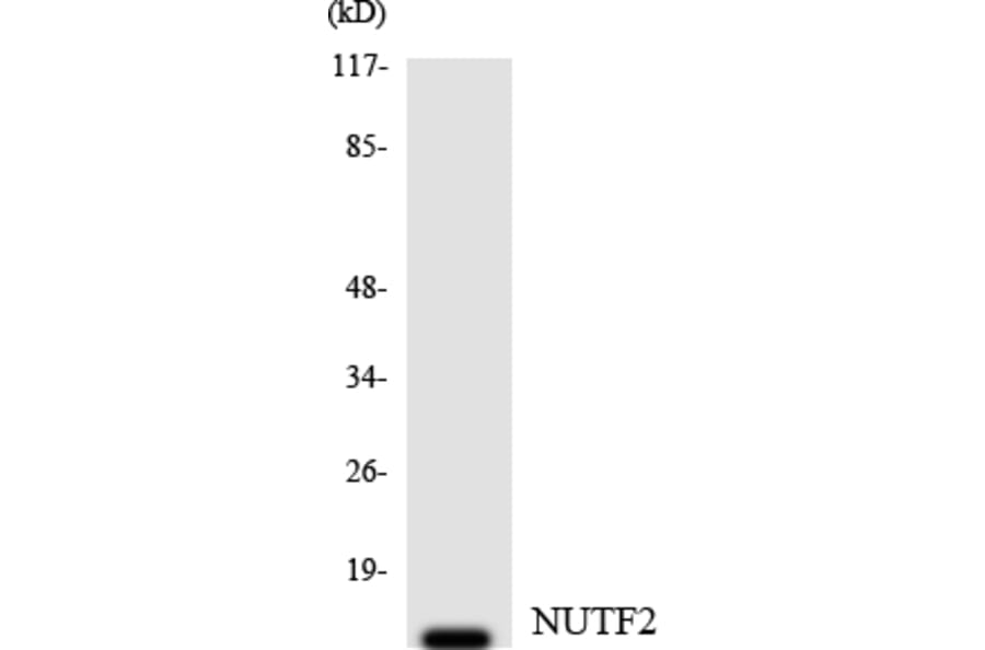 Western Blot - Anti-NUTF2 Antibody (R12-3115) - Antibodies.com