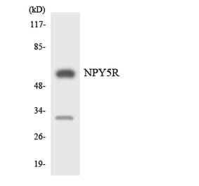 Western Blot - Anti-NPY5R Antibody (R12-3104) - Antibodies.com
