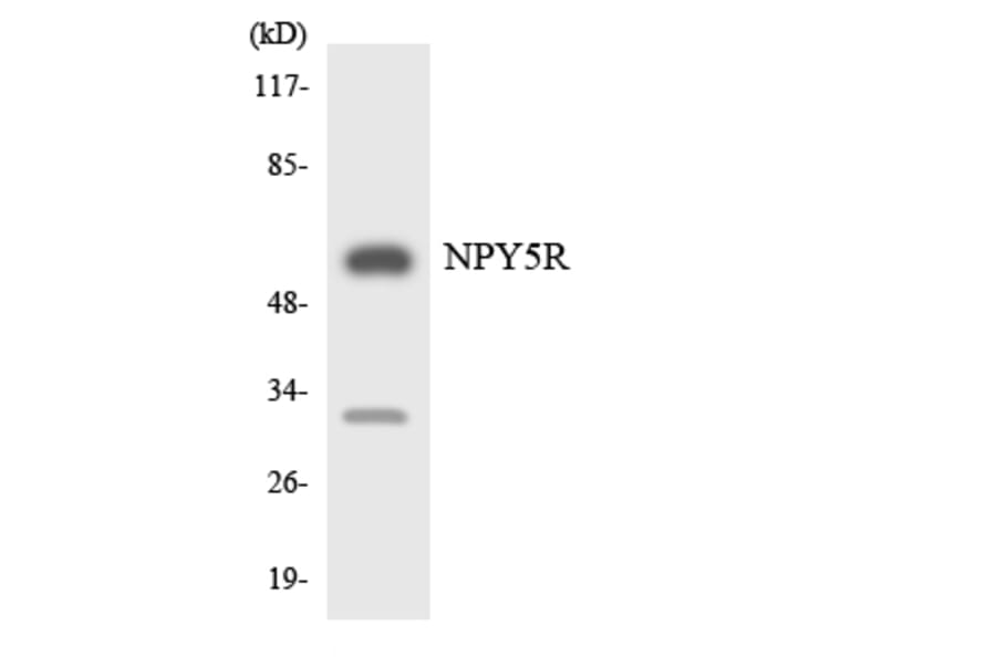 Western Blot - Anti-NPY5R Antibody (R12-3104) - Antibodies.com