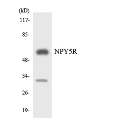 Western Blot - Anti-NPY5R Antibody (R12-3104) - Antibodies.com