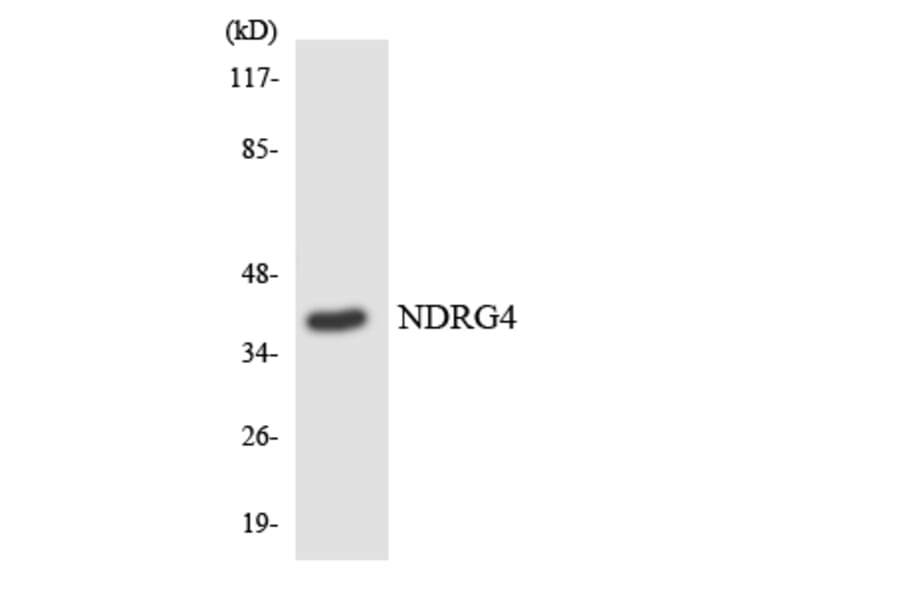 Western Blot - Anti-NDRG4 Antibody (R12-3081) - Antibodies.com