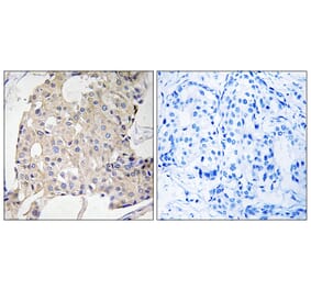 Immunohistochemistry - Anti-NDRG3 Antibody (C18000) - Antibodies.com