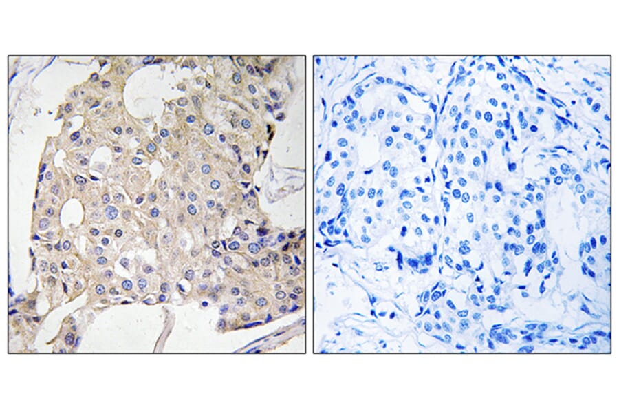 Immunohistochemistry - Anti-NDRG3 Antibody (C18000) - Antibodies.com