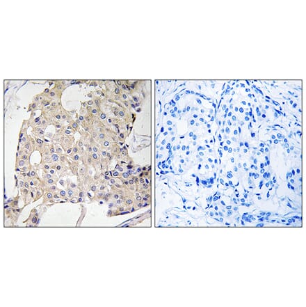 Immunohistochemistry - Anti-NDRG3 Antibody (C18000) - Antibodies.com