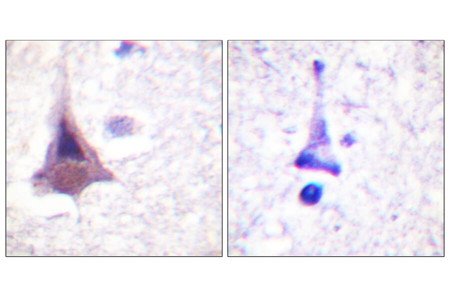 Immunohistochemistry - Anti-MYPT1 Antibody (B0518) - Antibodies.com