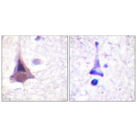 Immunohistochemistry - Anti-MYPT1 Antibody (B0518) - Antibodies.com