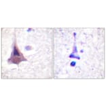 Immunohistochemistry - Anti-MYPT1 Antibody (B0518) - Antibodies.com