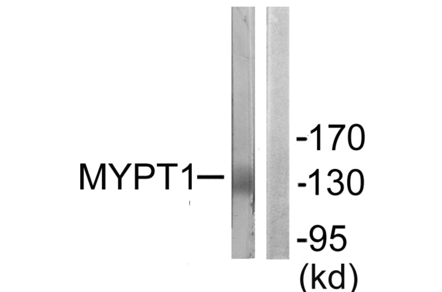 Western Blot - Anti-MYPT1 Antibody (B0518) - Antibodies.com