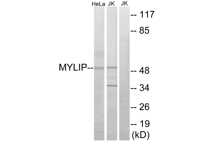 Western Blot - Anti-MYLIP Antibody (C15558) - Antibodies.com