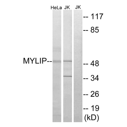 Western Blot - Anti-MYLIP Antibody (C15558) - Antibodies.com