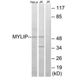 Western Blot - Anti-MYLIP Antibody (C15558) - Antibodies.com