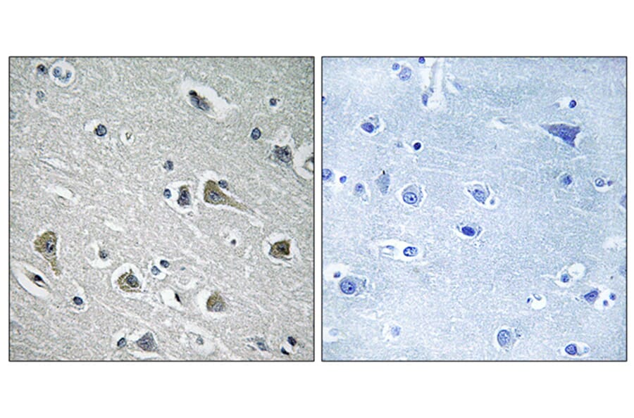 Immunohistochemistry - Anti-MYLIP Antibody (C15558) - Antibodies.com