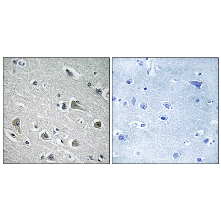 Immunohistochemistry - Anti-MYLIP Antibody (C15558) - Antibodies.com