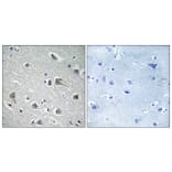 Immunohistochemistry - Anti-MYLIP Antibody (C15558) - Antibodies.com