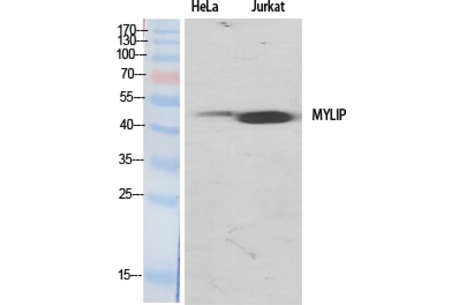 Western Blot - Anti-MYLIP Antibody (C15558) - Antibodies.com