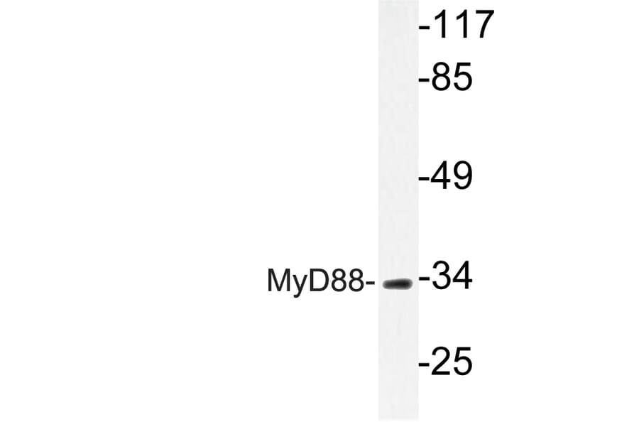Western Blot - Anti-MyD88 Antibody (R12-2244) - Antibodies.com