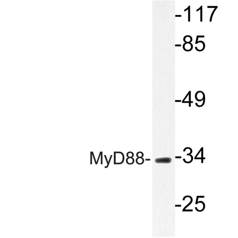 Western Blot - Anti-MyD88 Antibody (R12-2244) - Antibodies.com