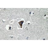 Immunohistochemistry - Anti-MyD88 Antibody (R12-2244) - Antibodies.com