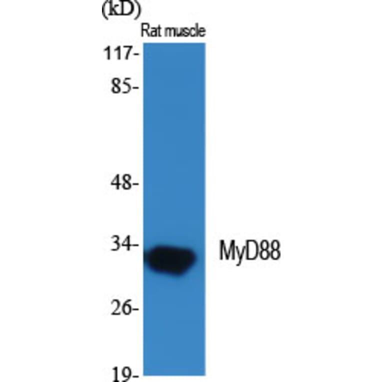 Western Blot - Anti-MyD88 Antibody (R12-2244) - Antibodies.com