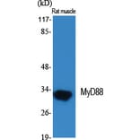 Western Blot - Anti-MyD88 Antibody (R12-2244) - Antibodies.com