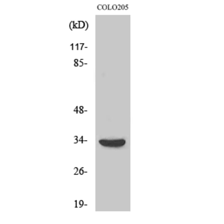 Western Blot - Anti-MyD88 Antibody (R12-2244) - Antibodies.com