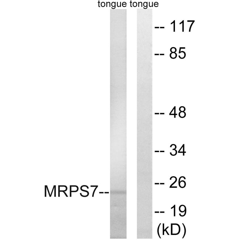 Western Blot - Anti-MRPS7 Antibody (C14044) - Antibodies.com