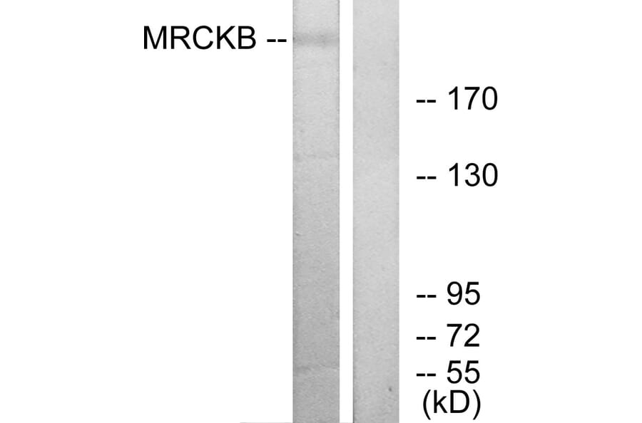 Western Blot - Anti-MRCKB Antibody (C11973) - Antibodies.com