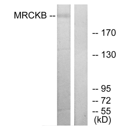 Western Blot - Anti-MRCKB Antibody (C11973) - Antibodies.com