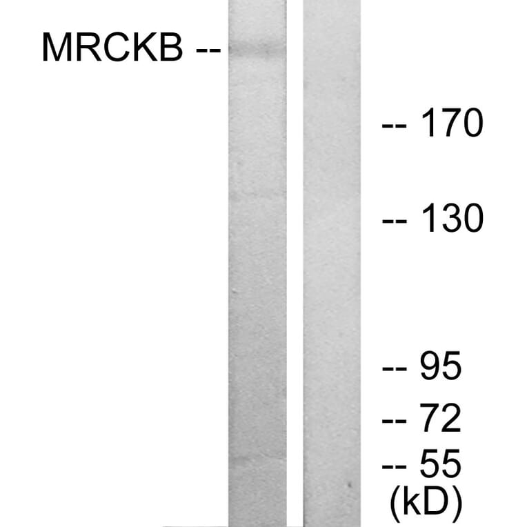 Western Blot - Anti-MRCKB Antibody (C11973) - Antibodies.com