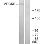 Western Blot - Anti-MRCKB Antibody (C11973) - Antibodies.com