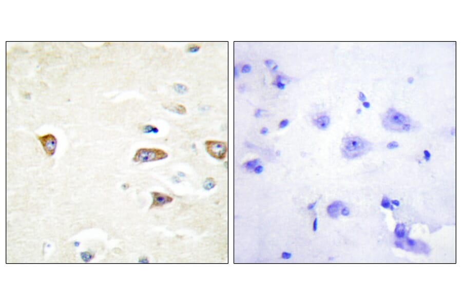 Immunohistochemistry - Anti-MRCKB Antibody (C11973) - Antibodies.com