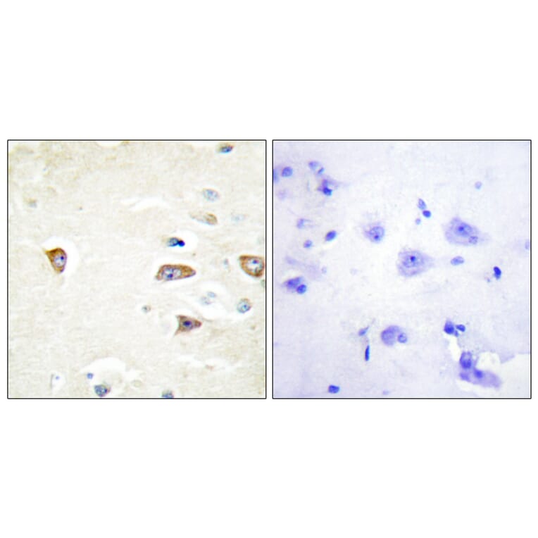 Immunohistochemistry - Anti-MRCKB Antibody (C11973) - Antibodies.com