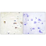 Immunohistochemistry - Anti-MRCKB Antibody (C11973) - Antibodies.com