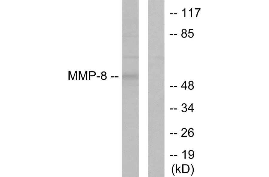 Western Blot - Anti-MMP-8 Antibody (C0274) - Antibodies.com