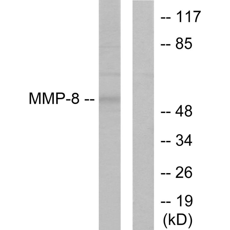 Western Blot - Anti-MMP-8 Antibody (C0274) - Antibodies.com