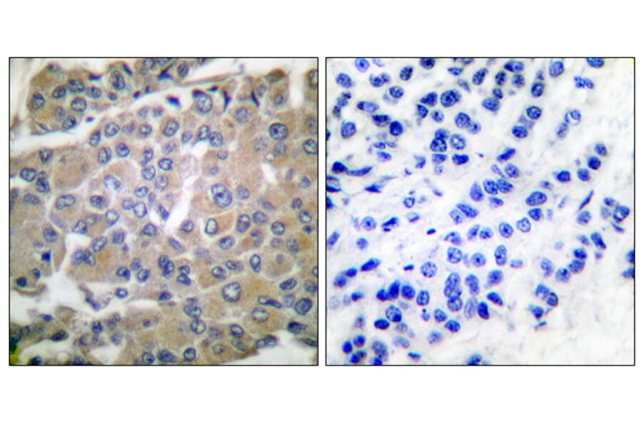 Immunohistochemistry - Anti-MMP-8 Antibody (C0274) - Antibodies.com