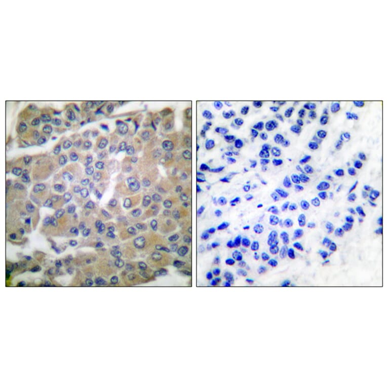 Immunohistochemistry - Anti-MMP-8 Antibody (C0274) - Antibodies.com