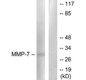 Western Blot - Anti-MMP-7 Antibody (C0273) - Antibodies.com