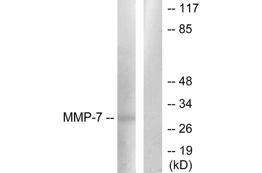 Western Blot - Anti-MMP-7 Antibody (C0273) - Antibodies.com