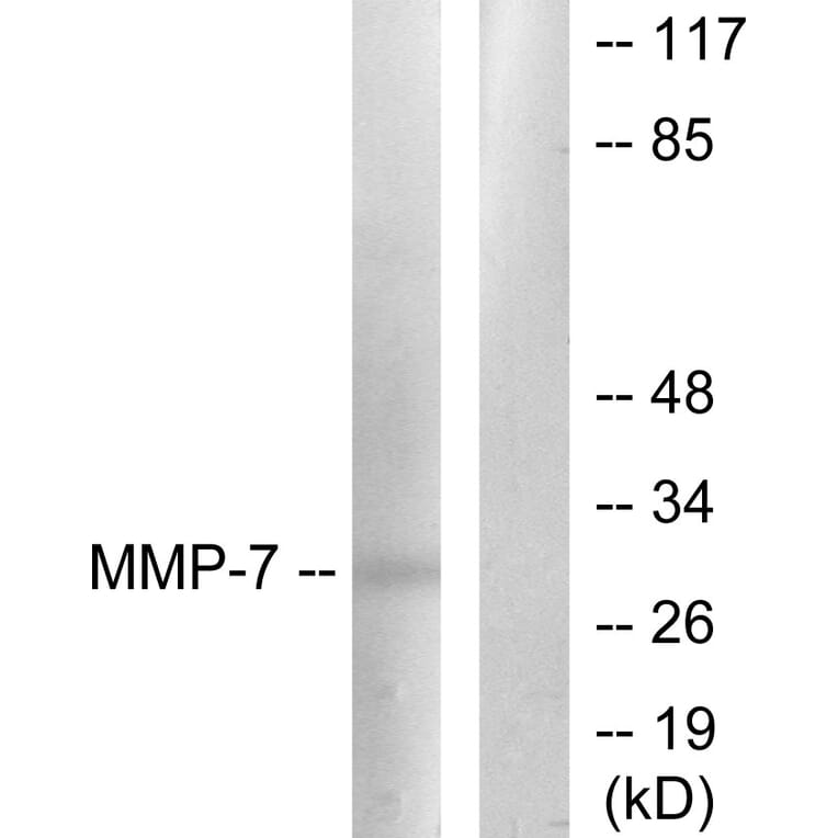 Western Blot - Anti-MMP-7 Antibody (C0273) - Antibodies.com