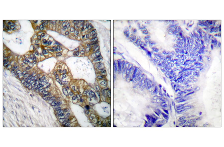 Immunohistochemistry - Anti-MMP-7 Antibody (C0273) - Antibodies.com