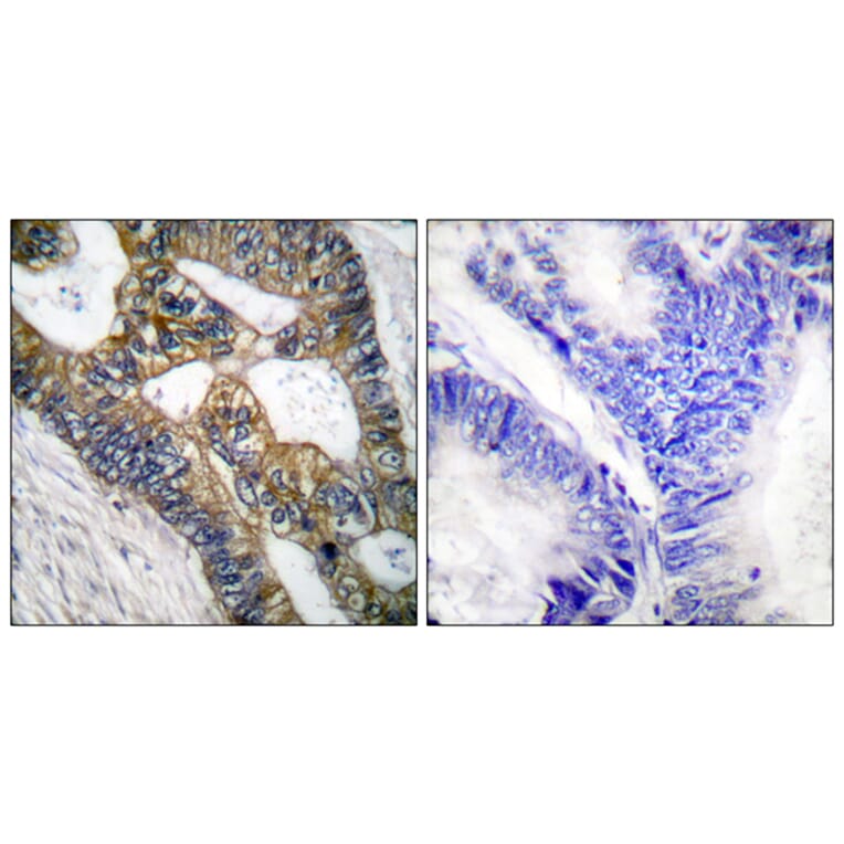 Immunohistochemistry - Anti-MMP-7 Antibody (C0273) - Antibodies.com