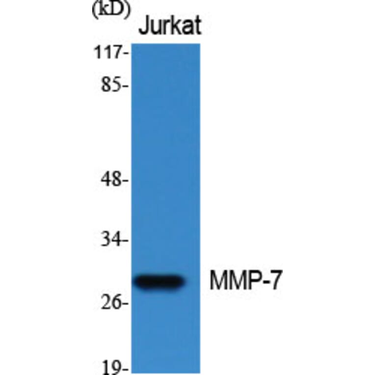 Western Blot - Anti-MMP-7 Antibody (C0273) - Antibodies.com