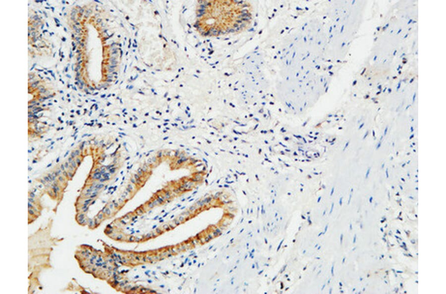 Immunohistochemistry - Anti-MMP-7 Antibody (C0273) - Antibodies.com