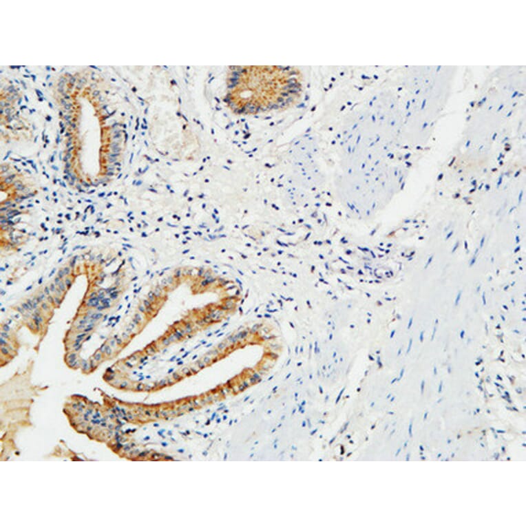 Immunohistochemistry - Anti-MMP-7 Antibody (C0273) - Antibodies.com