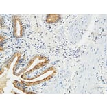 Immunohistochemistry - Anti-MMP-7 Antibody (C0273) - Antibodies.com