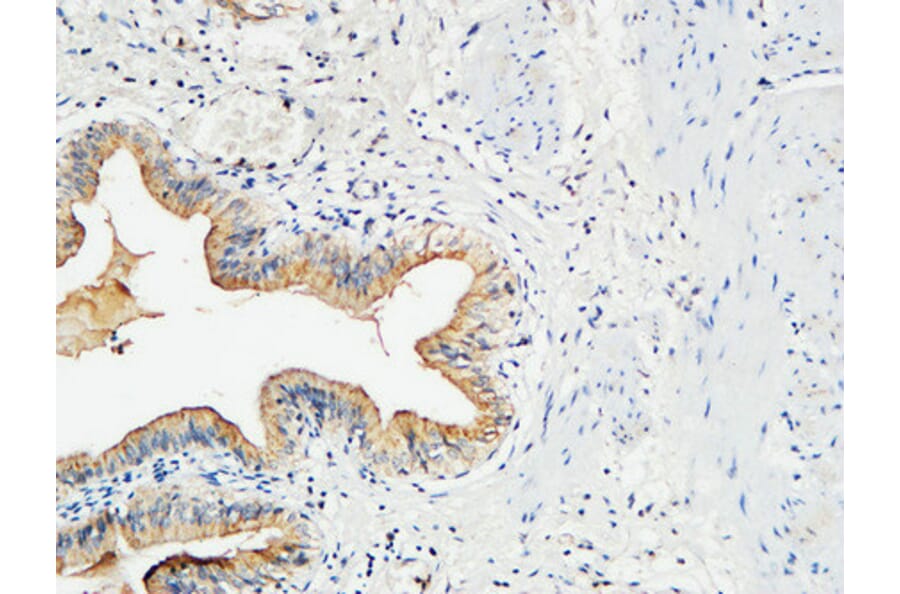 Immunohistochemistry - Anti-MMP-7 Antibody (C0273) - Antibodies.com