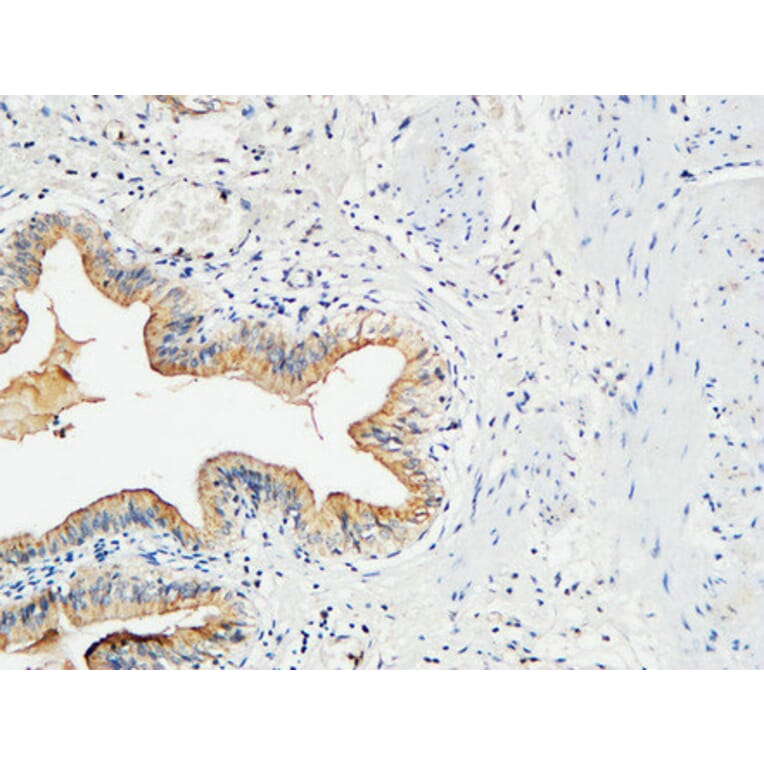 Immunohistochemistry - Anti-MMP-7 Antibody (C0273) - Antibodies.com