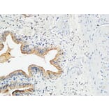 Immunohistochemistry - Anti-MMP-7 Antibody (C0273) - Antibodies.com