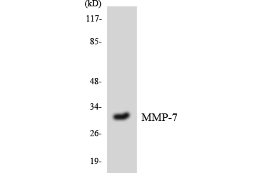 Western Blot - Anti-MMP-7 Antibody (R12-3022) - Antibodies.com